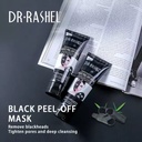 DR.RASHEL BLACK PEEL-OFF MASK NEW